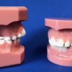 Mckinney orthodontics | We are most helpful