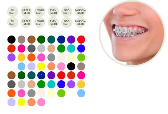 Mckinney Orthodontics Brace Colors