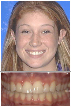 Mckinney Orthodontics After 4