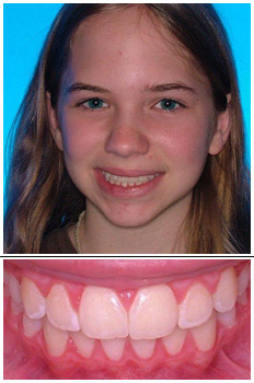 Mckinney Orthodontics After 5