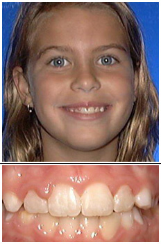 Mckinney Orthodontics After 7
