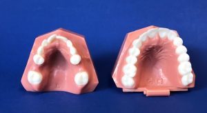 Mckinney Orthodontics Blog 11