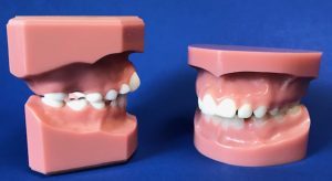 Mckinney Orthodontics Blog 12