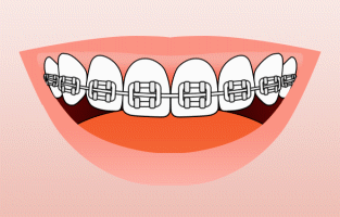 Mckinney Orthodontics Brushing 1