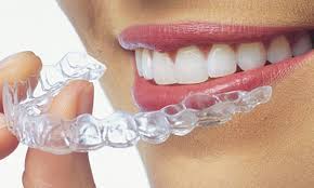 Mckinney Orthodontics Invisalign 1